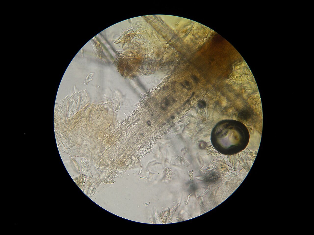 Microscope view of a cat hair with numerous small fungal spores along the hair shaft